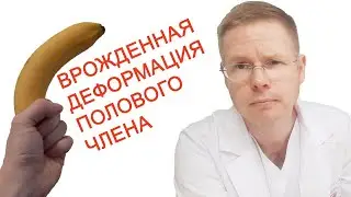 Врожденная деформация полового члена / Доктор Черепанов