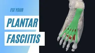 Cure Plantar Fasciitis fast with THIS Stretching Trick! #short