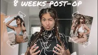 Boob Job Update/Q&A • 8 weeks
