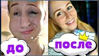 Как стать красивой и Как отбелить зубы!