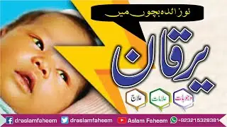 Jaundice In New Born Babies Symptoms & Treatment | What is Neonatal Jaundice its Causes & Treatment