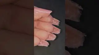 Gel jelly for upper forms, YES or NO ⁉️ 
