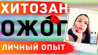 #Тяньши #Отзыв Личный опыт. Ожог. Отзыв о продукции компании #Тiens.