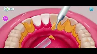 ASMR Fix Dental Issues and Remove ear worm | Satisfying Video