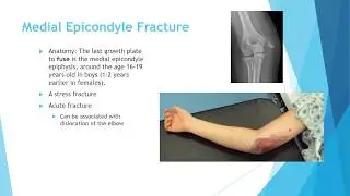 pediatric trauma 3
