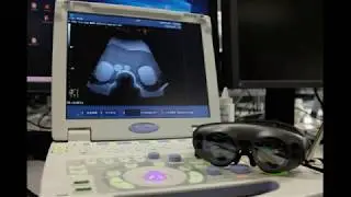 Magic Leap Demo:AR Echography Based On Markerless Tracking