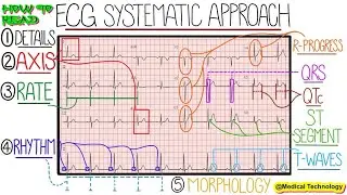 How to Read ECG Report | Medical Technology