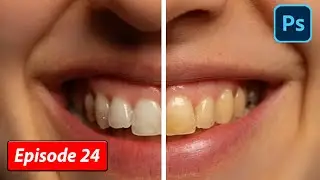 How to Whiten Teeth in Photoshop