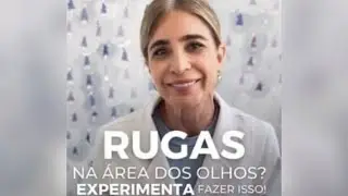 RUGAS AO REDOR DOS OLHOS: EXPERIMENTE ISSO!