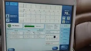 Parameter check