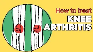 How to Treat Knee Arthritis: 11 Tips to Avoid Knee Surgery!