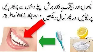 Daanto Ki Peelahat Door Karne Ka Gharelu Totka Daanto Ki Safai In Urdu Teeth Cleaning At Home