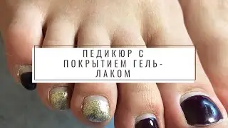 Педикюр с покрытием гель-лаком
