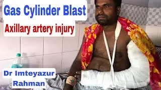 Axillary artery injury,vascular injury , saphenous vein graft,pulse oximetry in vascular injury,