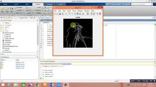 Implementation of Edge detection techniques  in Matlab