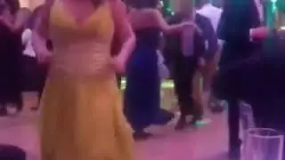 One legged girl dancing at the party