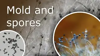 Mold and Mold Spores Under a Microscope: Rhizopus Stolonifer (12x-2500x)