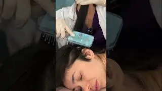 Asmr scalp tingles #asmr #asmrsounds #asmrvideo #relax #relaxing #satisfying #hair #sleep #tingles