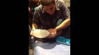 Fisioterapia Respiratoria con AMBUL