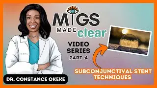 MIGS Made Clear - Xen Gel Stent Part 4 - Learn about Subconjunctival Stents