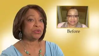 Hair Loss Solutions; ReAllusions Client, Pat