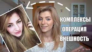 СДЕЛАЛА ОПЕРАЦИЮ В 19 ЛЕТ / НЕ КРАСИВАЯ значит НЕ СЧАСТЛИВАЯ ? / комплексы из-за внешности
