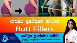 පස්ස ලස්සන  කරන Butt Fillers | 360 wellness & Skin Clinic#Buttfillers