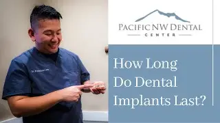 How Long Do Dental Implants Last?