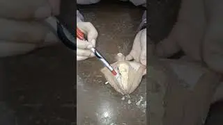 Reproductive 7 female external genitalia