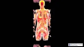 Whole body - Structural magnetic resonance imaging