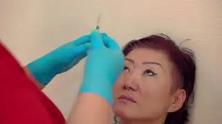 Инъекционная косметология