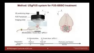 Yan Gong: Sonication Patterns and Microbubble Administration for FUS-Mediated Drug Delivery