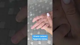Алиса сильно ударила пальчик 