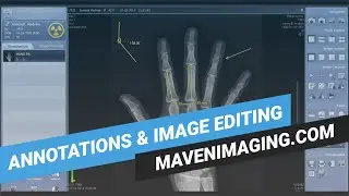 Rayence Part 2 - Annotations & Image Editing