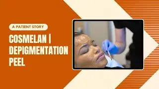 A Patient Story | Cosmelan | Depigmentation Peel | West Hollywood, CA | Dr. Jason Emer