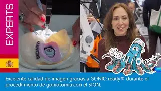 OCULUS GONIO ready® - Testimonial by Analisa Arosmena, MD