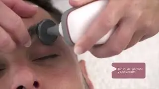 Cómo es una sesión de Indiba Facial
