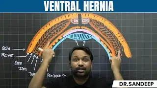 Ventral Hernia & Mesh | Surgery Lectures | MBBS 4th Year | NEET PG | BLS Series | Dr Sandeep Sir