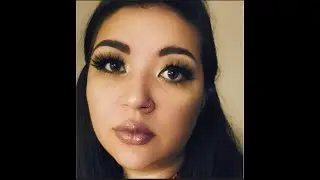 Chalyce's Story