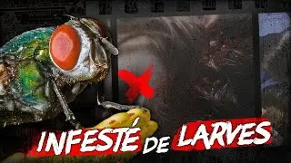 L'enfant qui avait 212 LARVES dans le ❌ CRÂNE