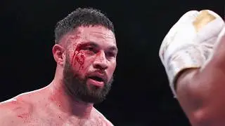 The Most Disrespected Champion In Boxing