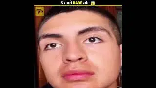 World's Most RARE Humans 😱 One in a Billion 
