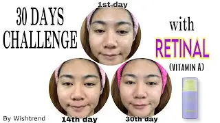 30 DAYS CHALLENGE Vitamin A-mazing Bakuchiol Night Cream PART 2