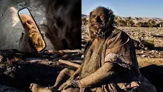 World's Dirtest Man | Not Bathed for 67 years