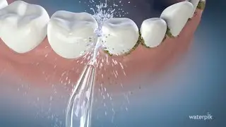 How to use the Waterpik® oral irrigator?