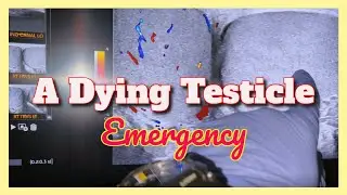 We Saved His Dying Testicle in 10 Seconds