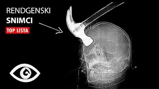 TOP 10: Brutalni Rendgenski Snimci - X ray