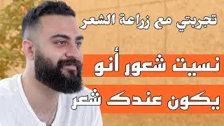 تجربتي مع زراعة الشعر بعد 6 أشهر | إسماعيل
