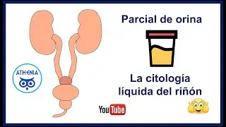 PARCIAL DE ORINA , UROANALISIS