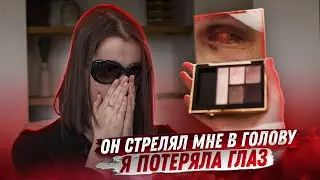 My Boyfriend Shot Me in the Head and I Lost an Eye / Miss X